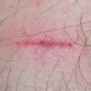 Unlocking the Body's Secrets: The Fascinating Science of Wound Healing